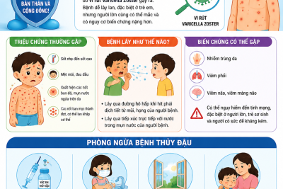 TT bệnh Thủy đậu_1